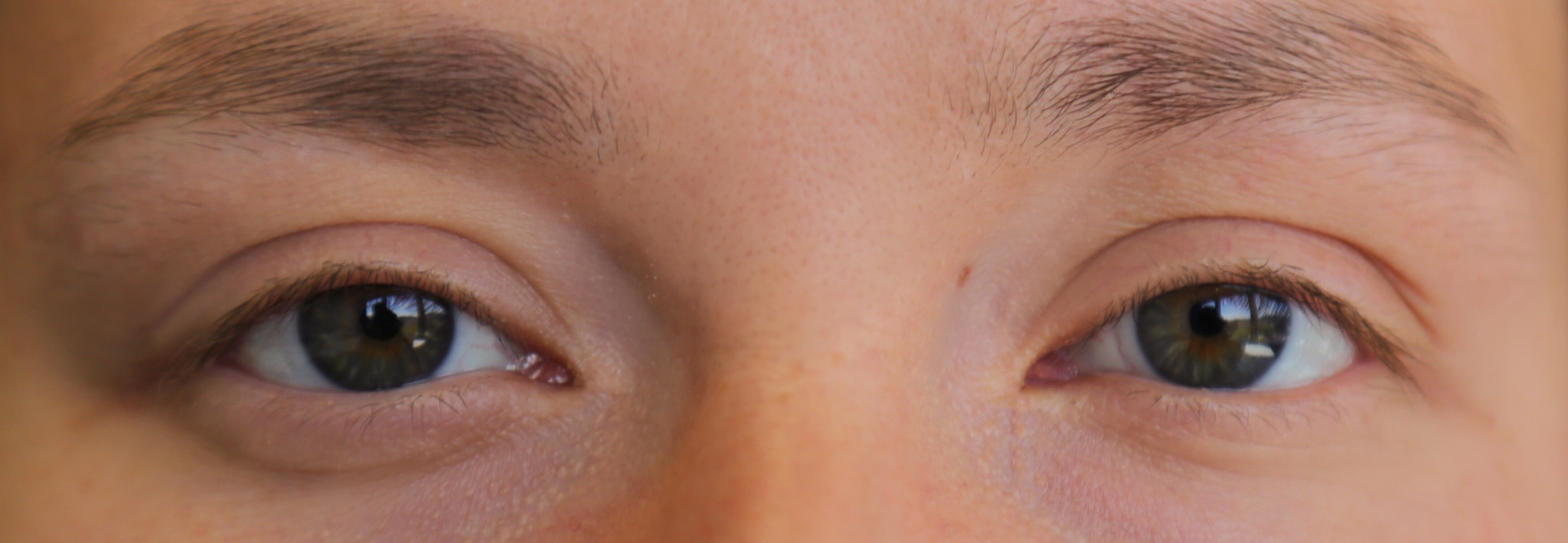 grüne Augen