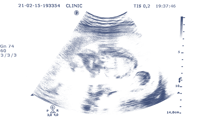Embryo